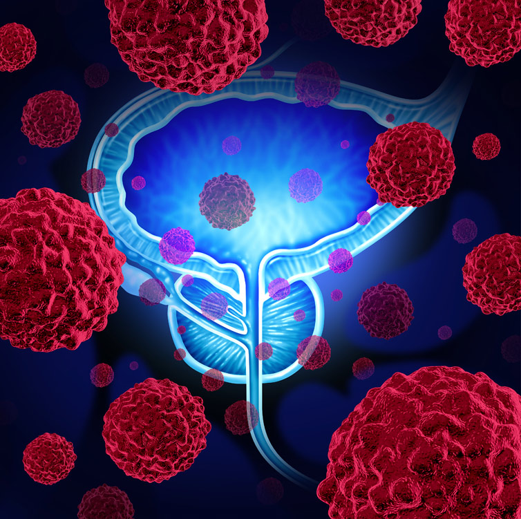 What happens during the treatment with Actinium-225 PSMA Therapy?