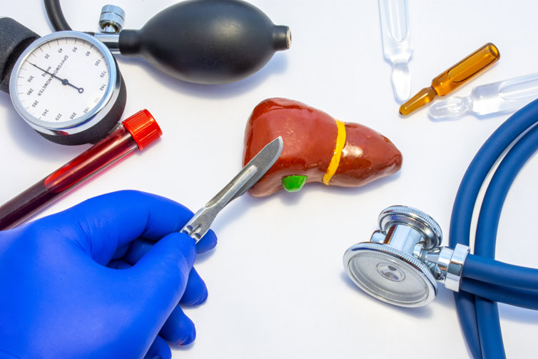 Liver Cancer Surgery In India