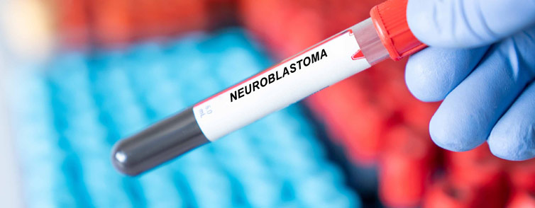 Early Diagnosis and Detection of Neuroblastoma Early Diagnosis and Detection of Neuroblastoma