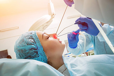 Nasal and Sinus Cancer Surgery in India