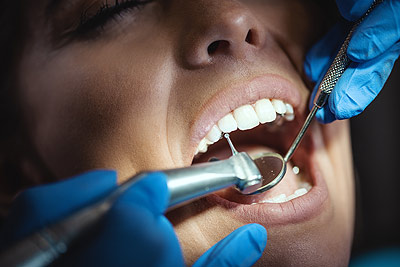 Dental Care in India