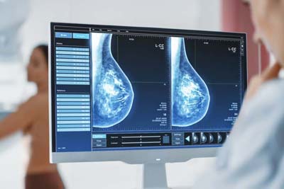 Breast Reconstruction Surgery in India