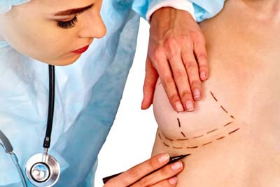 Breast Reduction Surgery in India