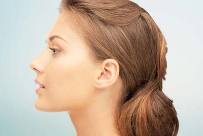 Cosmetic Rhinoplasty in India