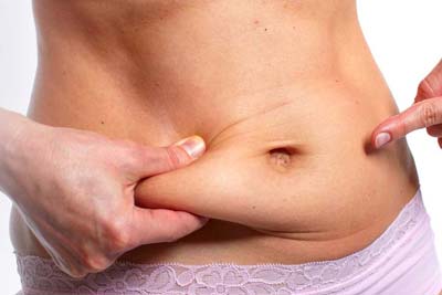 Tummy Tuck Surgery in India